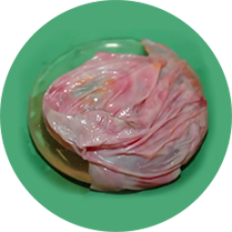 Breast Revision Surgery