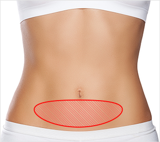 Breast Reconstruction