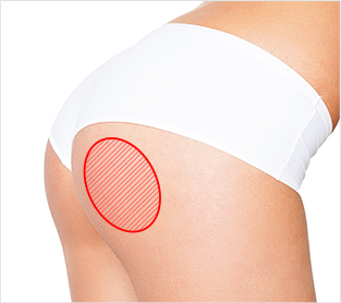 Breast Reconstruction